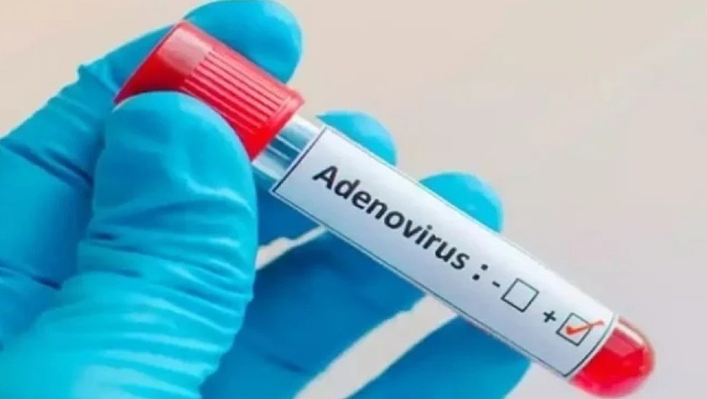 New viral infection surfaces in Karachi amid weather changes