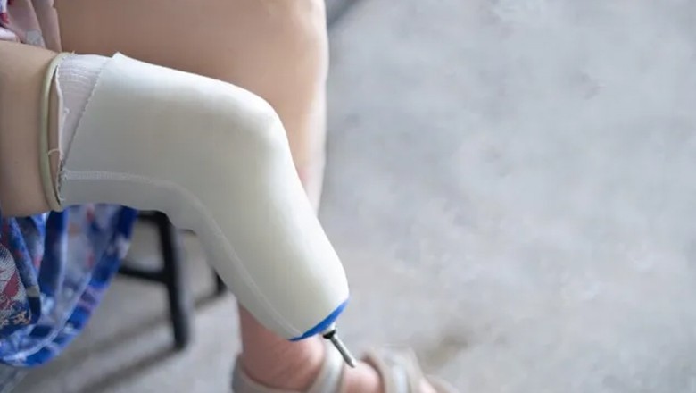 US man tries to trick Insurance company by cutting his own legs in strange plan