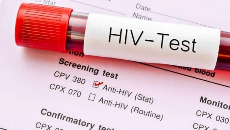 Pakistan reports over 9,700 HIV cases in 2024 amid alarming rise