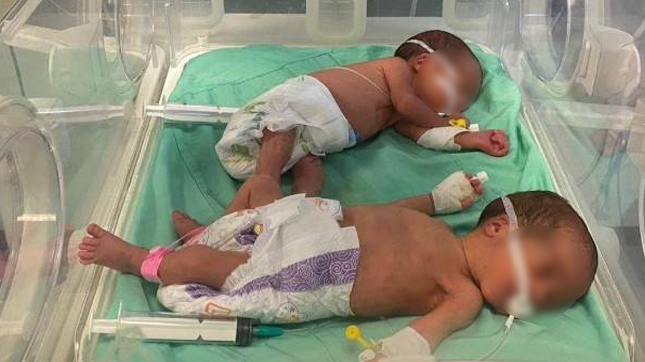 Woman injured in Multan gas tanker explosion gives birth to twins
