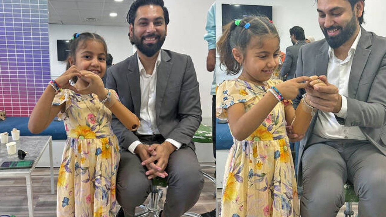 Pakistani company fits war-affected Gaza girl with prosthetic arm
