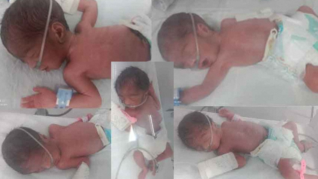 Woman gives birth to quintuplets in Karachi