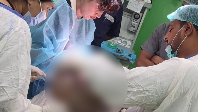 Karachi: Doctors remove metal lock from woman's stomach without surgery