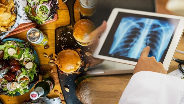 Ultra-processed food consumption may raise risk of lung cancer: study