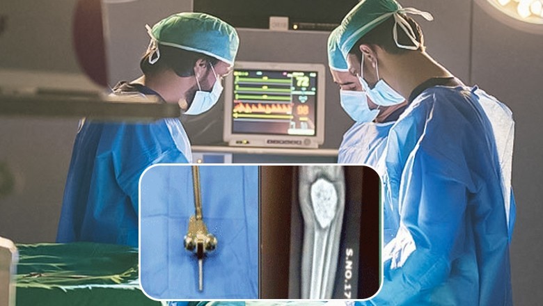 Karachi’s Jinnah Hospital performs first-ever successful knee cancer surgery