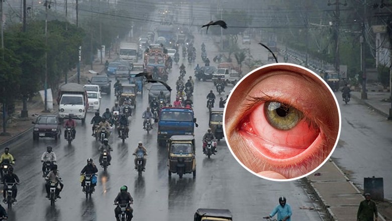 Rapid spread of conjunctivitis in Karachi amid monsoon season