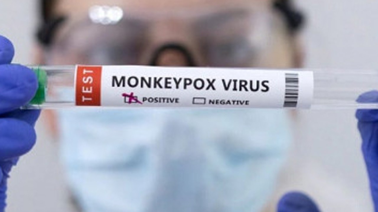 Lahore reports three new monkeypox cases