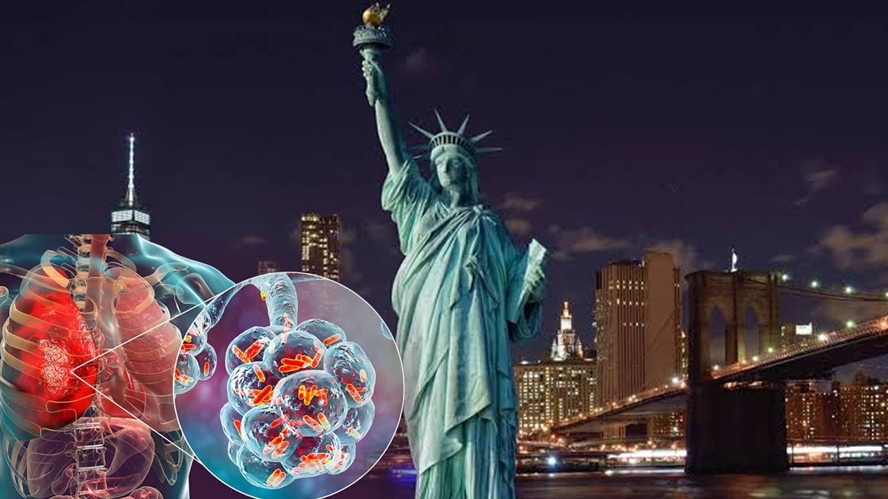 First death reported in New York Legionnaires' disease outbreak
