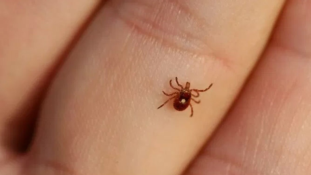 Karachi reports another Congo virus case
