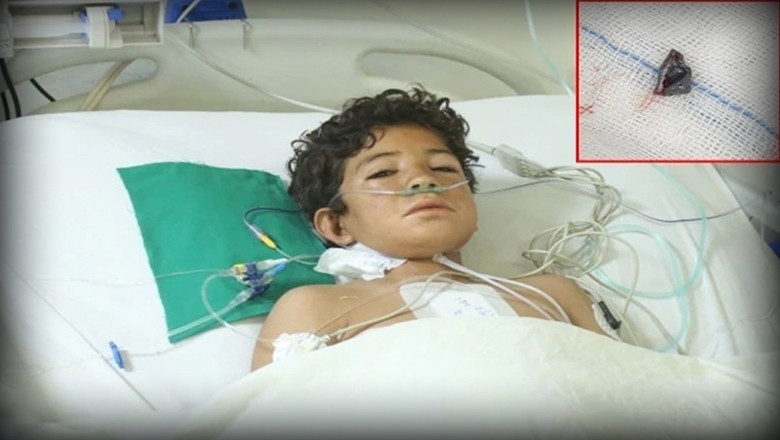 NICVD Karachi doctors successfully remove bullet from 12-year-old boy’s heart