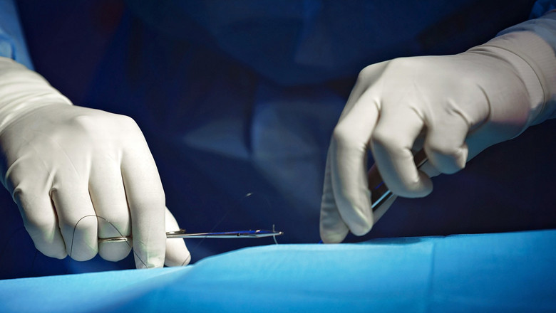 FIA arrests five over illegal kidney transplants, freezes Rs87.5m in property