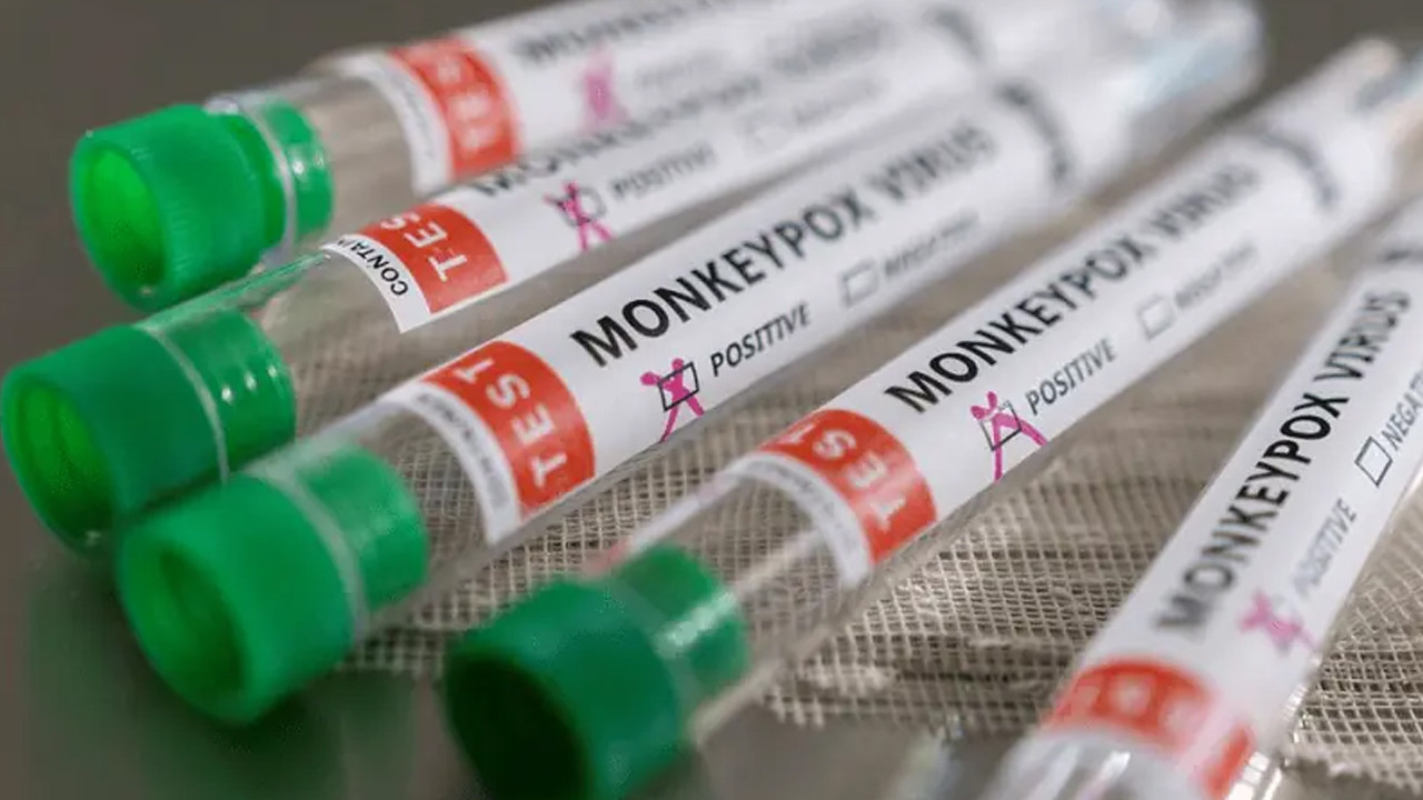 Sindh reports two new monkeypox cases, bringing the total to 95