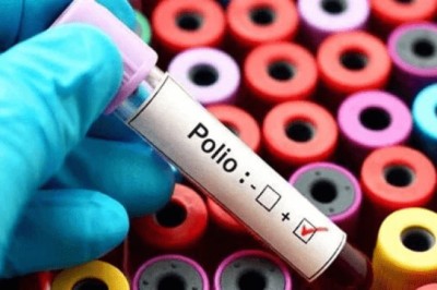ملک کے تین شہروں کے ماحولیاتی نمونوں میں پولیو وائرس کی تصدیق