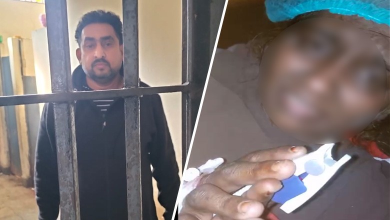 مالکن کے ہاتھوں جلائی جانے والی گھریلو ملازمہ کو دھمکیاں ملنے کا انکشاف