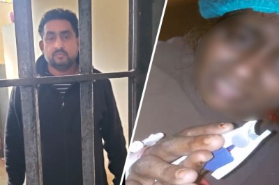 مالکن کے ہاتھوں جلائی جانے والی گھریلو ملازمہ کو دھمکیاں ملنے کا انکشاف