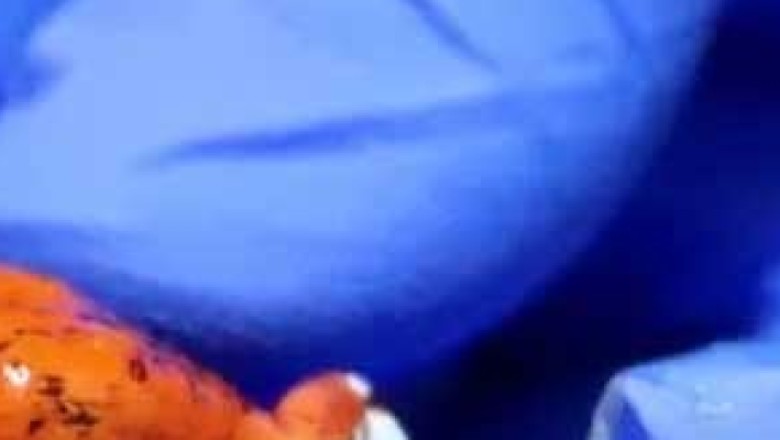 بیگ سے تین کروڑ سے زائد مالیت کے  مینڈک برآمد ہونے پر خاتون ایئرپورٹ سے گرفتار