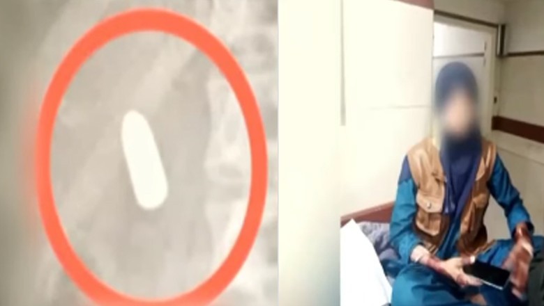 کراچی میں نوبیاہتا دلہن نے پستول کی گولی نگل لی