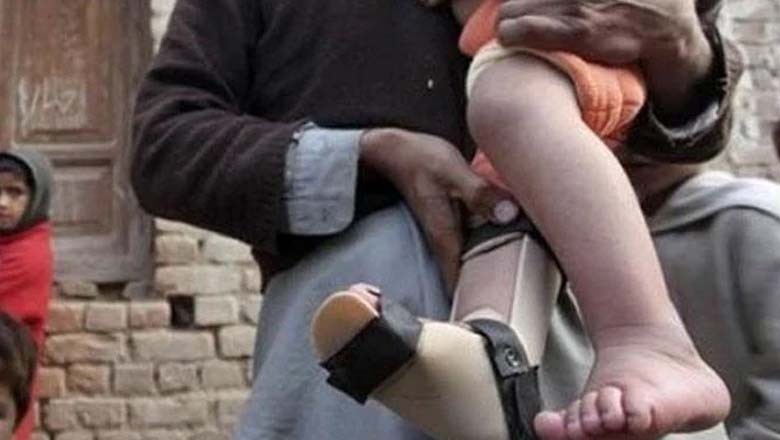 پاکستان میں پولیو کا دوسرا کیس سامنے آگیا