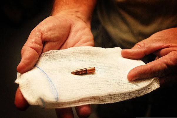 کراچی، والدین نے بچی کو لگنے والی گولی گھر پر ہی نکال دی