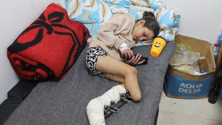 کولمبیا کا غزہ کے 50 فلسطینی بچوں کو مصنوعی اعضا فراہم کرنے کا اعلان