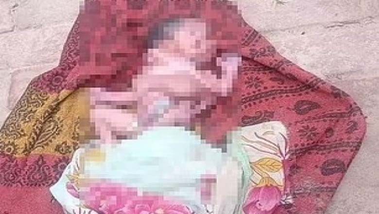 بھارت میں 2چہروں اور 4 ٹانگوں، بازوں کے حامل انوکھے بچے کی پیدائش