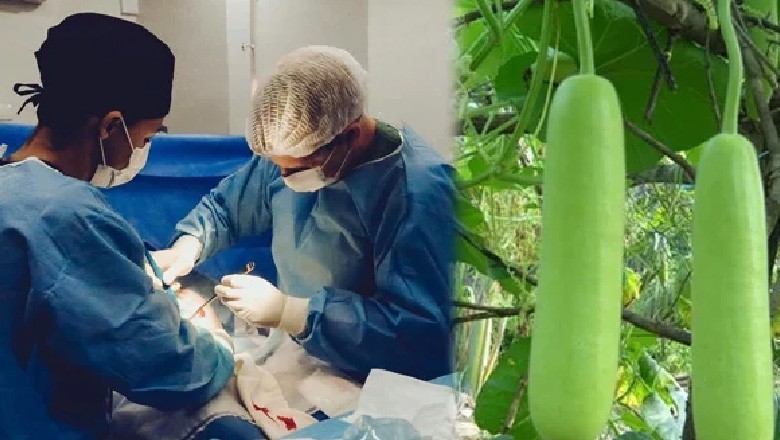 مریض کے پیٹ سے لوکی برآمد، مریض پریشان