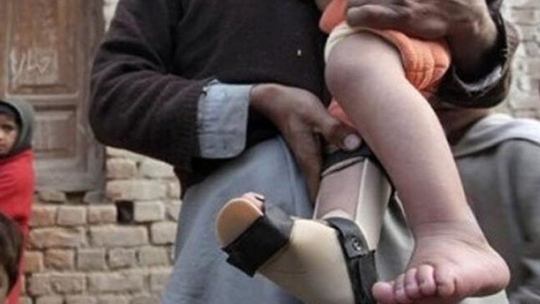 پنجاب میں 6 سالہ بچے کو پولیو کی تشخیص