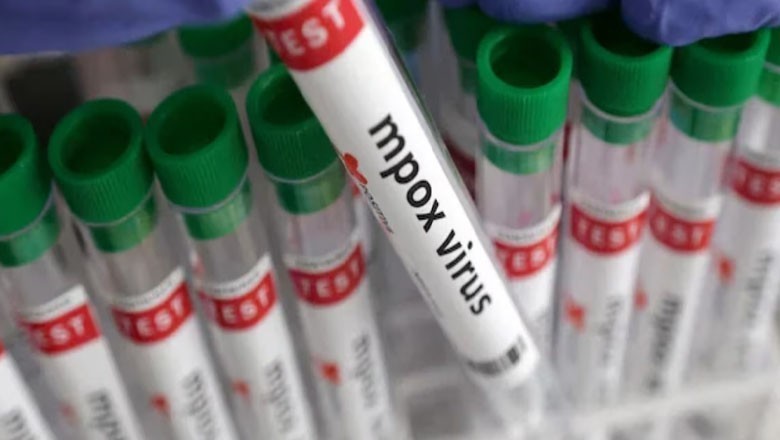 منکی پاکس وائرس کی بھی ویکسین تیار، منظوری بھی ہوگئی