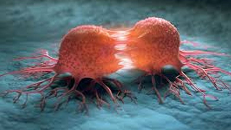 پاکستان میں کتنے فیصد لوگ کینسر کی کس قسم کا شکار ہیں؟ جانیے