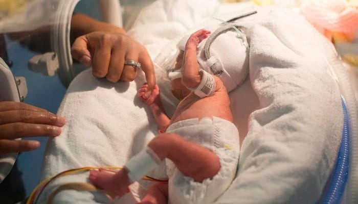 پاکستان میں سالانہ 75 ہزار بچے دل کی پیچیدہ بیماری کے ساتھ پیدا ہونے کا انکشاف