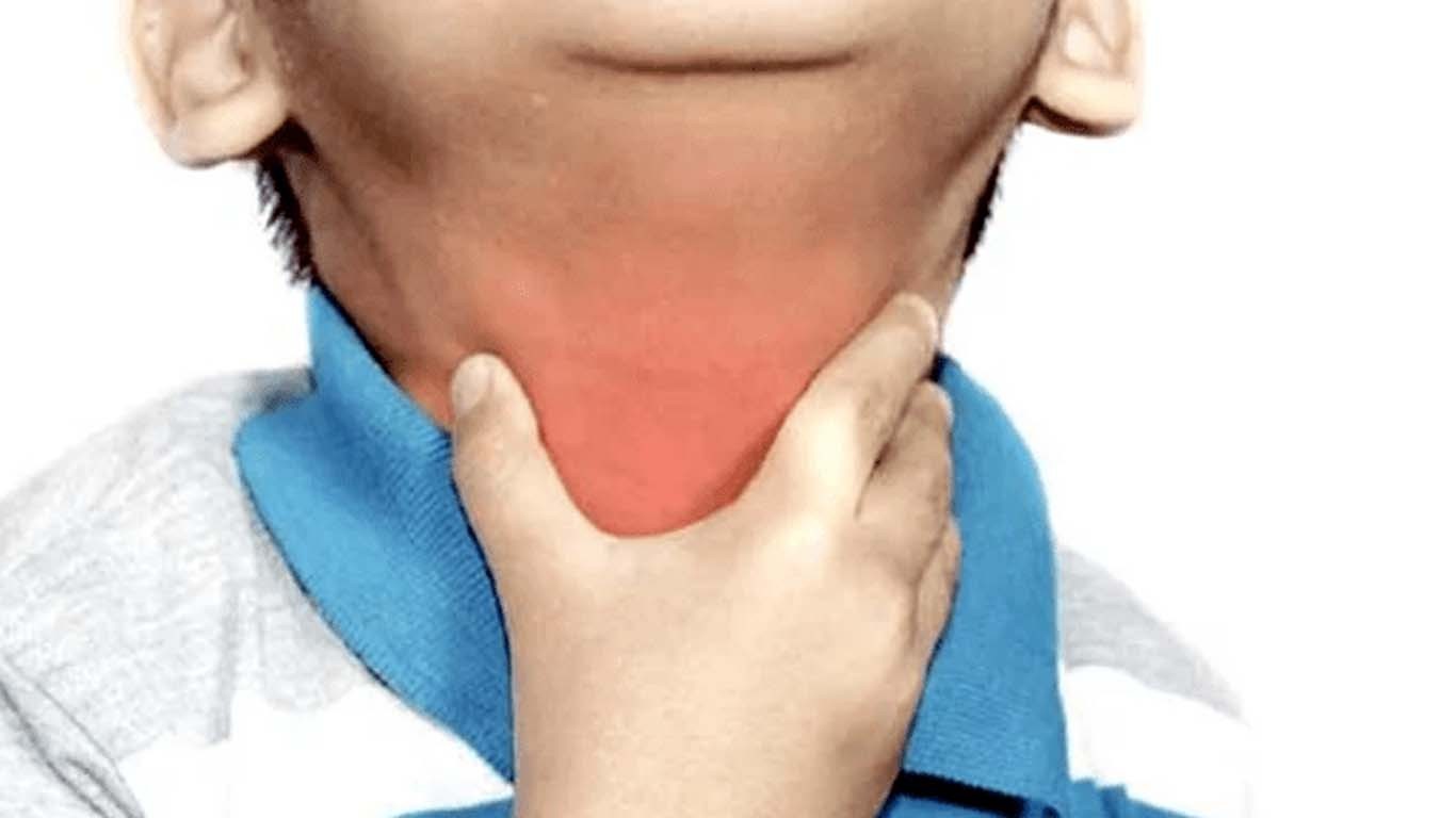 سندھ میں خناق تیزی سے پھیلنے لگا، 160 کیسز رپورٹ