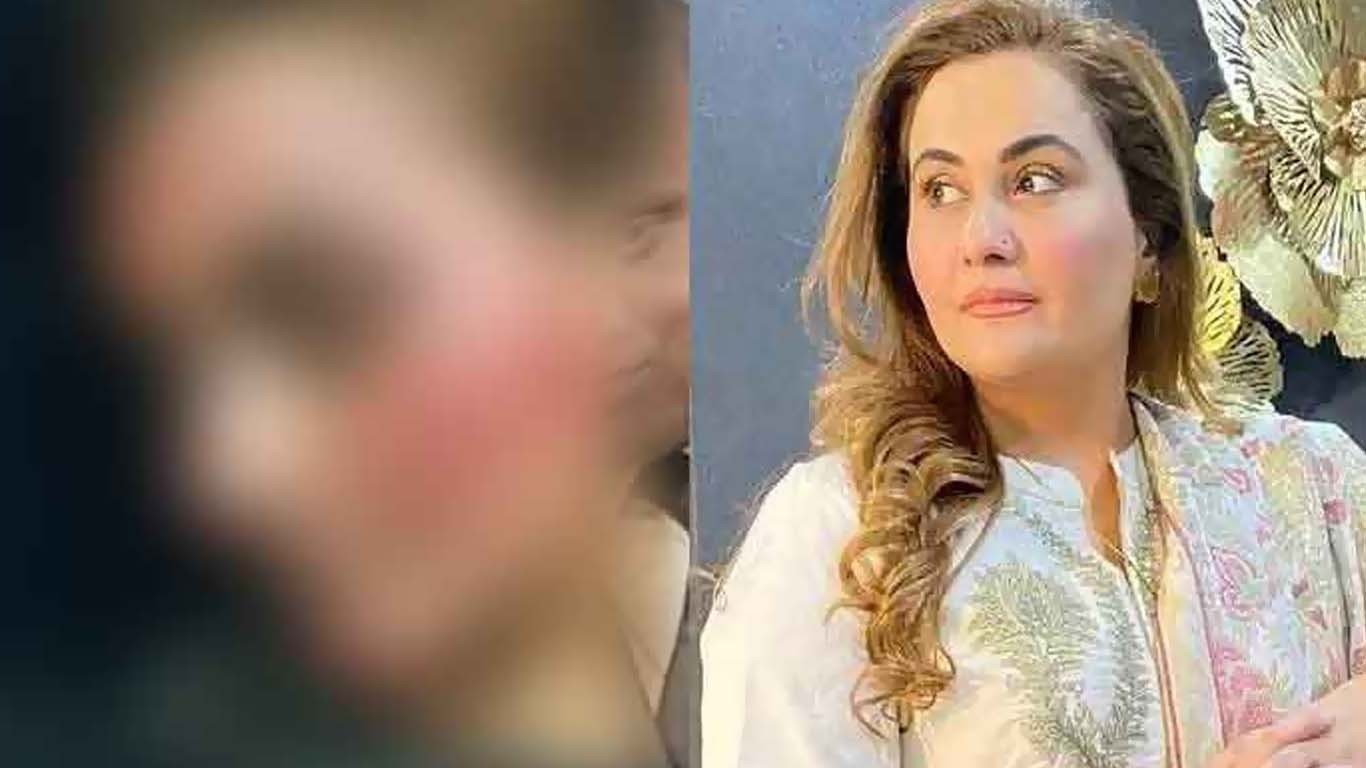 پاکستانی اداکارہ نرگس پر شوہر کا مبینہ تشدد