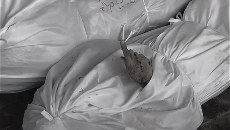 فلسطینی نوجوان شہادت دیتے ہوئے دنیا سے رخصت ہوگیا