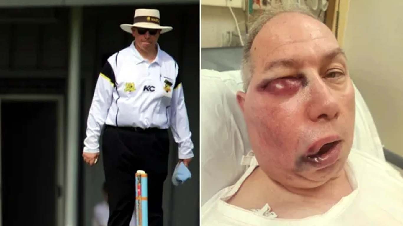 بلے باز کا شاٹ، گیند سیدھی امپائر کے منہ پر جا لگی