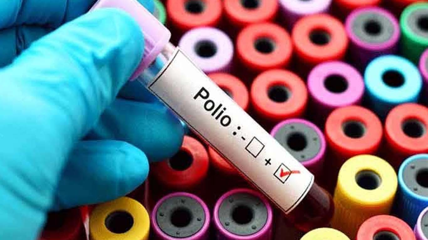 ملک میں پولیو کا نیا کیس سامنے آگیا