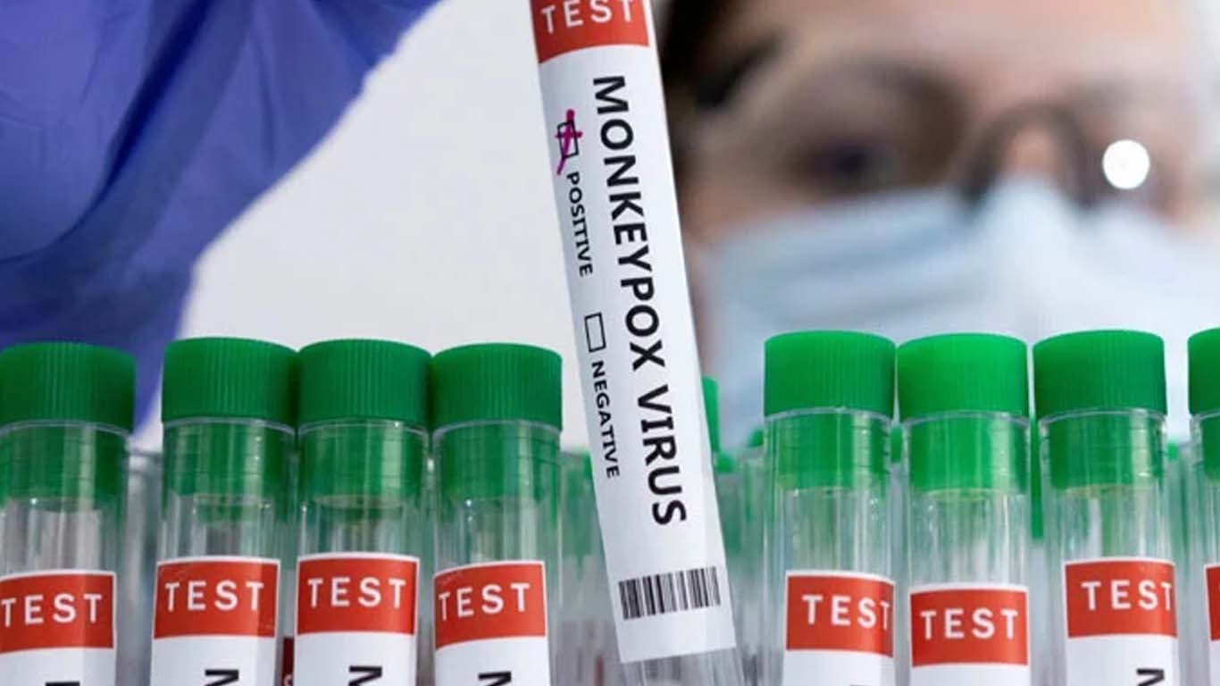 پاکستان میں ایم پوکس کا ایک اور کیس سامنے آگیا