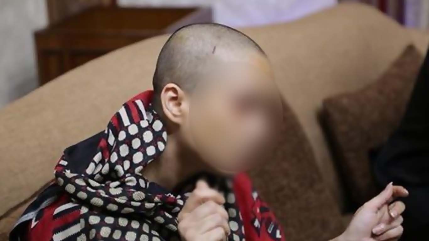 پسند کی شادی کی خواہش، گھر والوں نے لڑکی کا سر مونڈ دیا