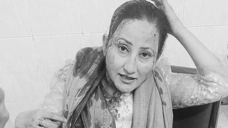 پشاور میں پختون روایت کے برعکس افسوسناک واقعہ