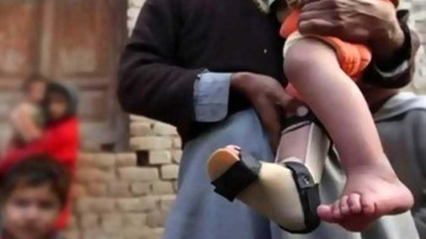 2025کا پہلا پولیو کیس ڈی آئی خان سے رپورٹ