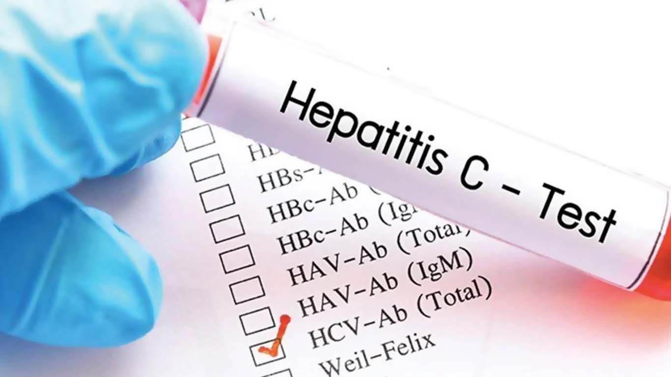 کراچی میں موذی مرض ہیپاٹائٹس تیزی سے پھیلنے لگا