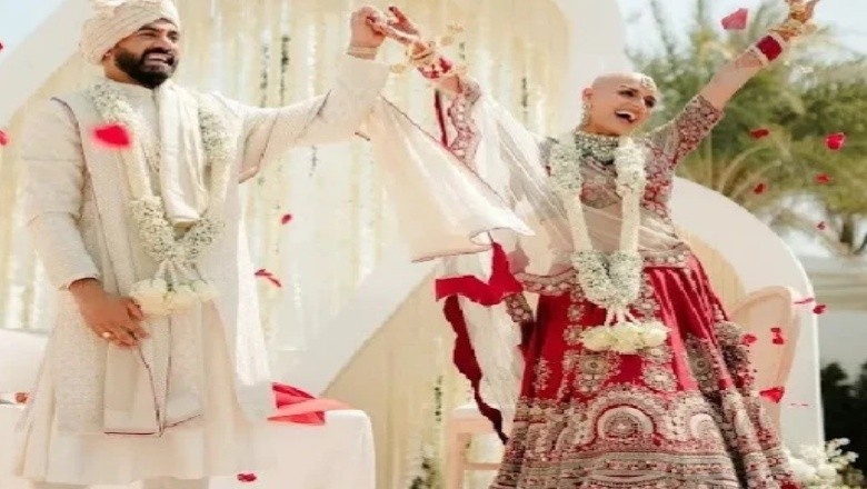 گنجی دلہن کی پر اعتمادی نے سب کے دل جیت لیے