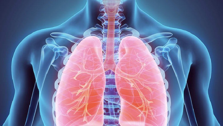 پاکستان میں کورونا طرز کی پھیپھڑے متاثر کرنے والی بیماری پھیلنے لگی