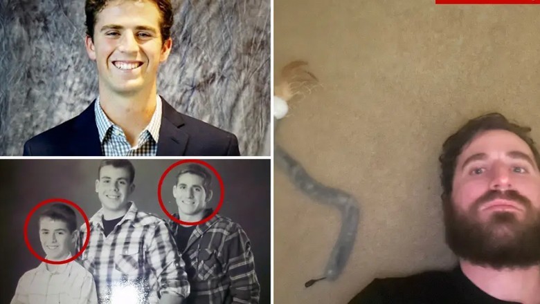 امریکا، سفاک شخص نے بھائی کو قتل کر کے آنکھ نکال کر کھالی، بلی کو جلا دیا