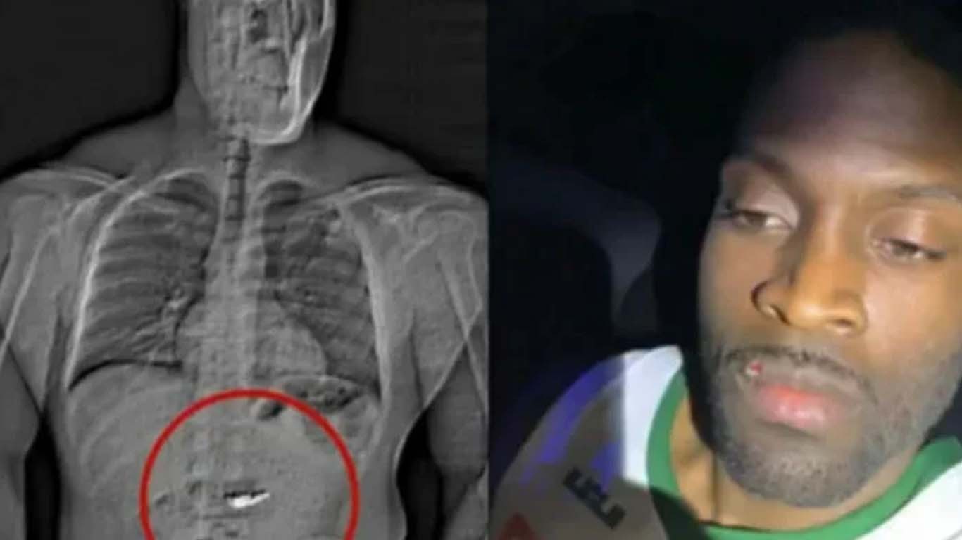 چور گرفتاری سے بچنے کیلئے 14 کروڑ کی طلائی بالیاں نگل گیا