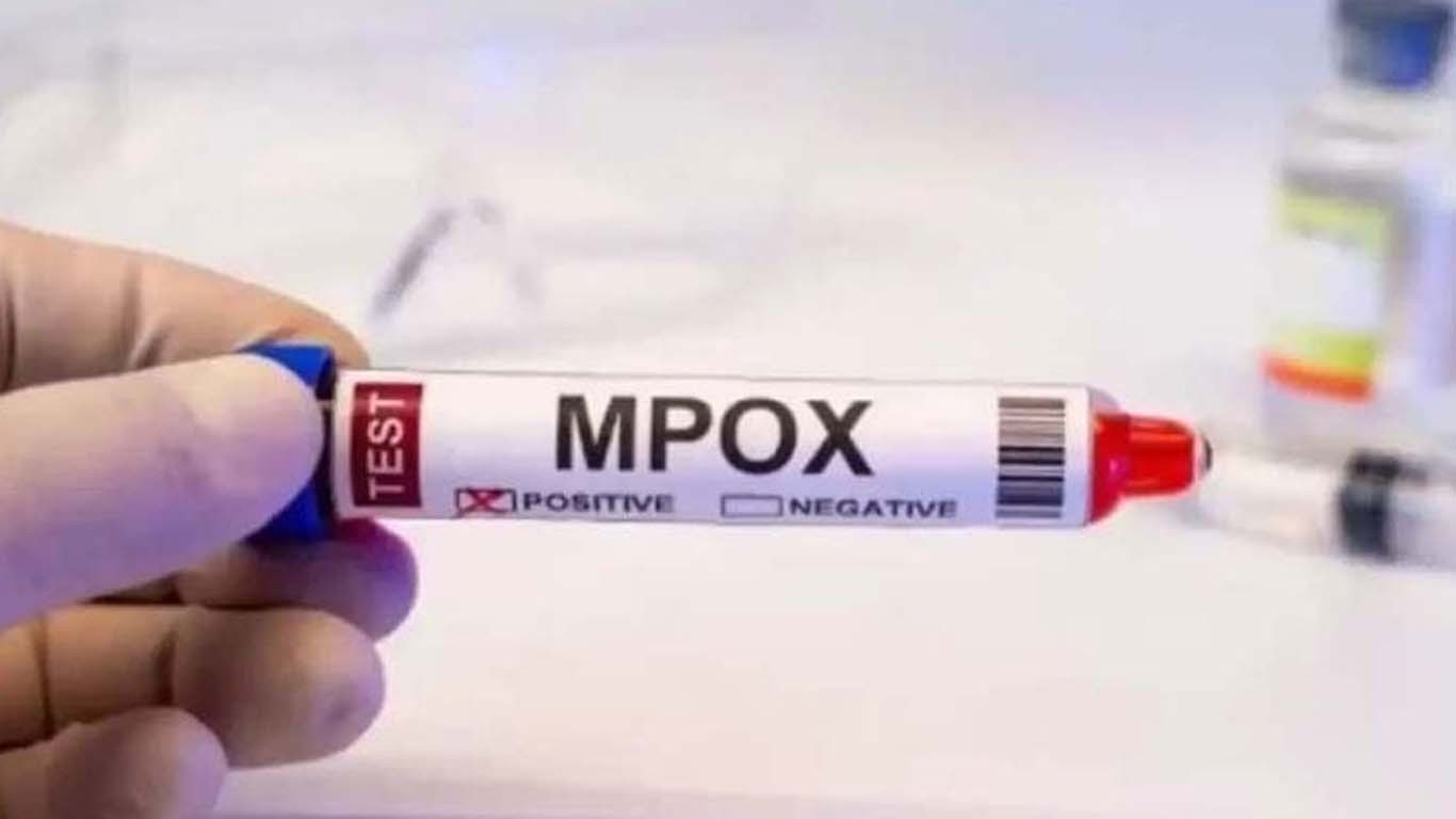 پاکستان میں ایم پاکس کے مزید دو کیسز سامنے آگئے