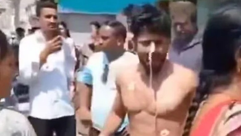 کومے کا مریض ہوش میں آتے ہی اسپتال سے بھاگ گیا
