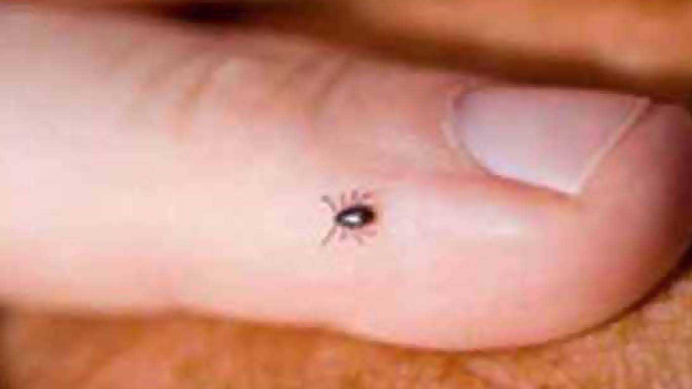 بلوچستان میں رواں سال کا کانگو کا پہلا کیس رپورٹ