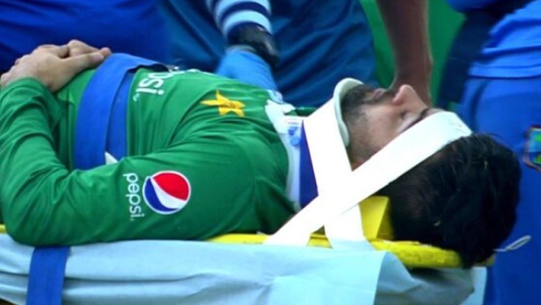 گیند لگنے سے زخمی امام الحق کی حالت اب کیسی ہے؟ ڈاکٹرز کا اہم بیان