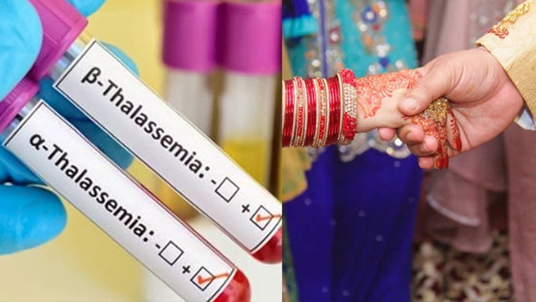 حکومت کا شادی سے قبل تھیلیسیمیا کا ٹیسٹ لازمی قرار دینے کا فیصلہ