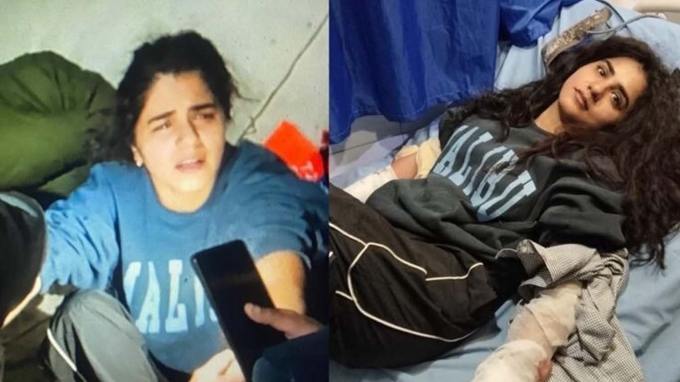 ریچھ کے حملے میں زخمی گلوکارہ قر العین بلوچ کا پہلا بیان سامنے آگیا